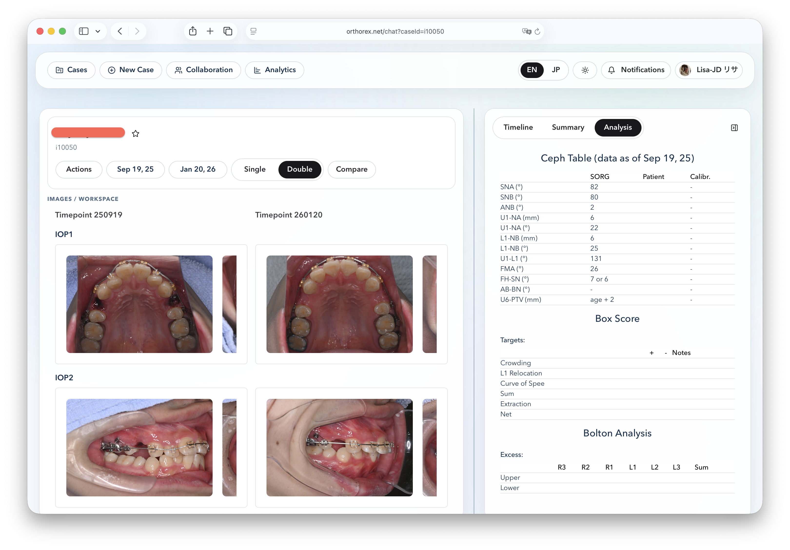 Orthodontic case example illustration